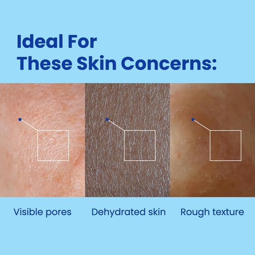 Regine Switzerland Hyaluronic Squalane Microshot Cream - Deep Hydrating Face Moisturizer for Radiant Skin - 1.75 fl. oz (50ml)