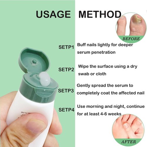 Natural Nail Care Gel, Nutraboost Strengthening Cuticle Serum for Damaged & Brittle Nails, 20ml (1 pcs) (2pcs)