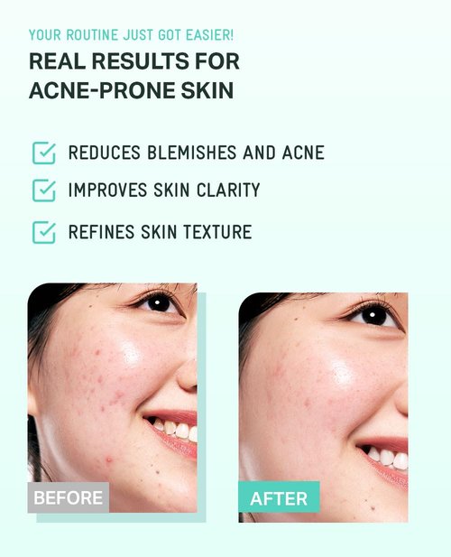 BRING GREEN Tea Tree Cica Soothing Cream Plus 100ml Korean Skin care, calming and soothing, moisturizer for skin, facial cream, trouble care, Blackhead Removing Pore care (Pack of 1)