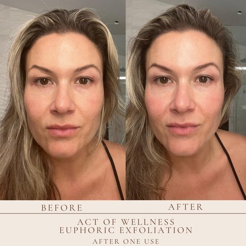 Euphoric Exfoliation Facial Peel - Weekly Treatment for Baby Smooth Skin | Vegan Lactic & Glycolic Acid (2oz & 1oz)