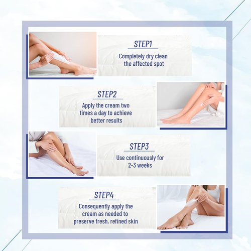 OUKEYA Urea Cream with Salicylic Acid for Dry, Rough Skin – Moisturiser for Feet, Heels, Hands & Elbows, 5.29 Oz