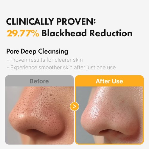 Hanskin PHA Pore Cleansing Oil - Deep Pore Makeup & Sebum Remover for Sensitive Skin | 10.14oz