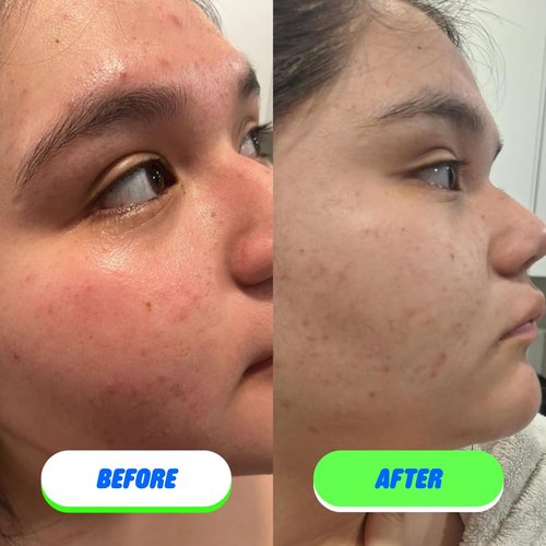 Pipa Skin Saver Hypochlorous Acid Spray for Face & Body 60 ml | Head to Toe Daily First Aid Skin Repair Spray for Sensitive Skin | Helps Reduce Eczema, Irritations, Rashes, Acne, Redness & Breakouts