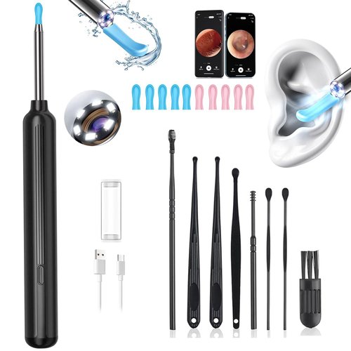 Ear Wax Removal, Ear Wax Removal Tool Camera with 1080P and 6 LED Lights, Ear Cleaner with 10 Replacement Tips, Earwax Removal Kit with Camera and 7 Pcs Ear Picks for Android/iOS