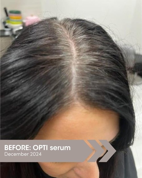 SEVEN SATARA OPTI Shampoo - Hair Growth & Thinning Solution with Procapil + Capixyl | 7 fl oz