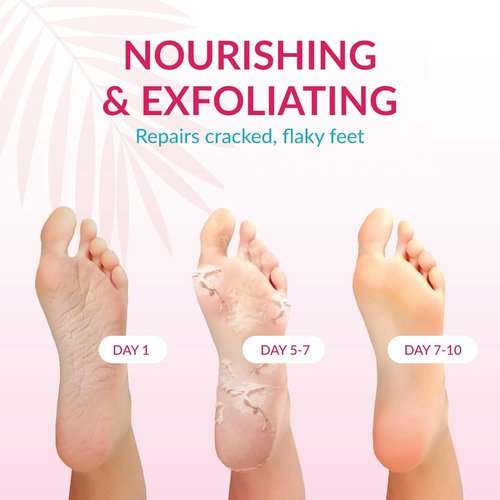 Summer Foot Peeling Mask That Removes Dead Skin - Dermatologically Tested Callus Remover for Dry Cracked Feet - Exfoliating Foot Peel Mask for Baby Soft Feet - 2 Pack with Cucumber & Urea Extracts
