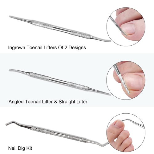 Ingrown Toenail Clipeprs, Toenail Clipper Straight Blade for Ingrown and Thick Nails, Ingrown Toenail Removal Kit include Tweezers, Ingrown Toenail File and Lifters (Black)