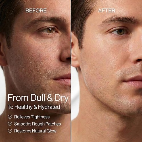 Anthony All-Purpose Facial Moisturizer - Hydrating Lotion for Dry Skin | Lightweight, Non-Comedogenic, Anti-Aging - 3 Fl Oz