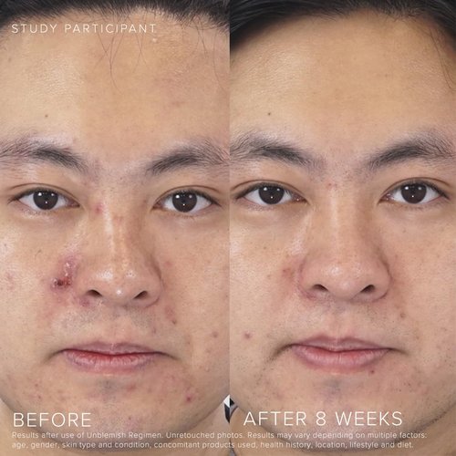 Rodan + Fields UNBLEMISH Invisible Matte Defense SPF 30 - Broad Spectrum Sunscreen for Face & Neck