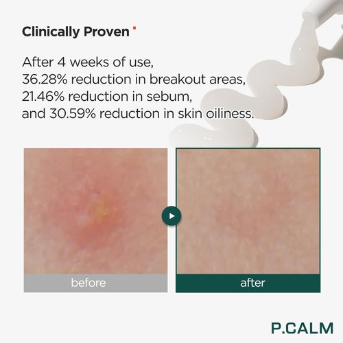 P.CALM Centella Trouble Spot Cream – Papaya Extract & Centella Asiatica for Intense Soothing & Spot Relief, Korean Skincare (15ml / 0.17 fl.oz)