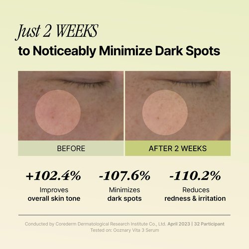 Ooznary Vita 3 Serum with Vitamin C Derivatives and Niacinamide plus Glutathione for Uneven Skin Tone & Dull Skin | Korean Skin care | 1.69 fl.oz 50ml