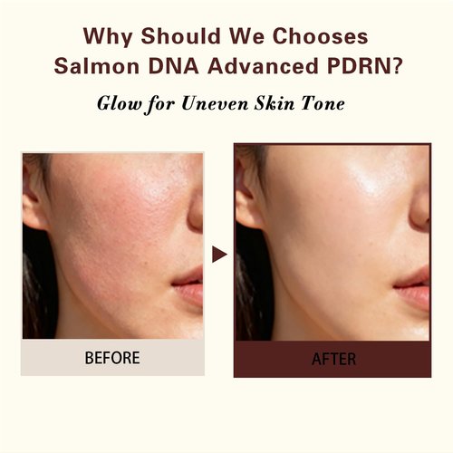 Advanced PDRN Rejuvenating Cream, 99% Pure Salmon DNA Collagen Gel Repair Cream, 0.7 oz, with Hyaluronic Acid and Niacinamide, Nighttime Skin Repair,Inspired Skincare