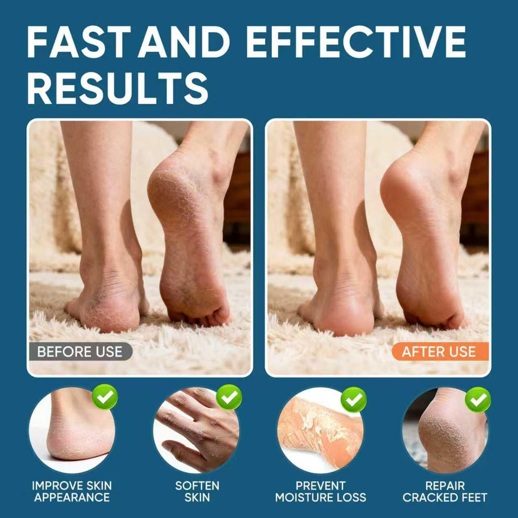 VREKEF Urea Cream 60% Plus Salicylic Acid 2%, Urea Cream 60 Percent for Feet Maximum Strength, Foot Cream for Dry Heels Cracked
