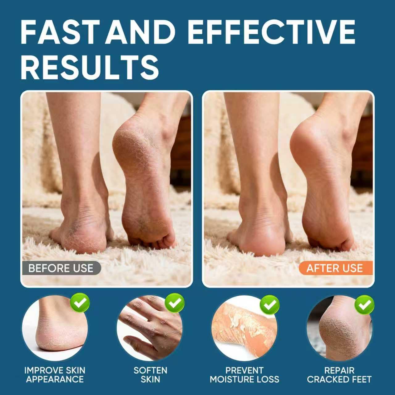 VREKEF Urea Cream 60% Plus Salicylic Acid 2%, Urea Cream 60 Percent for Feet Maximum Strength, Foot Cream for Dry Heels Cracked