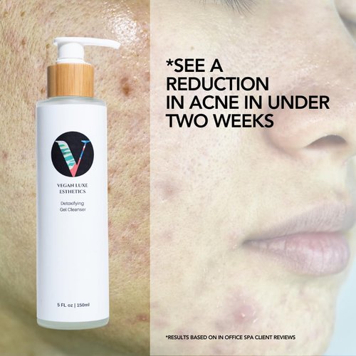 Vegan Luxe Esthetics Skincare I Detoxifying Gel Cleanser I Face Cleanser for Oily + Combination Skin Types I Controls Acne, Oil and Reduces the appearance of Pores.