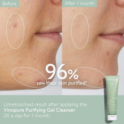 Caudalie Vinopure Salicylic Acid Cleanser - Pore Purifying Gel for Clear Skin | 150 mL