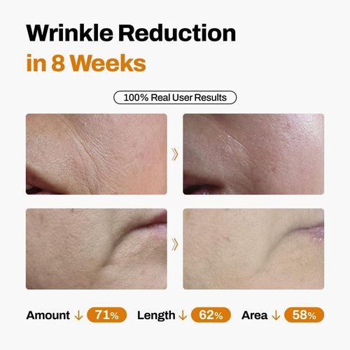 DermiShuttle Anti-Aging Lifting Kit - Firming Face Serum with Collagen & Peptides | 8-Week Hydration