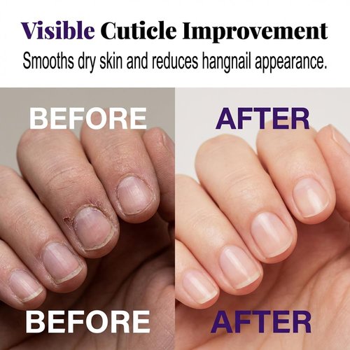 Skiennix Keratin Nail Strengthener - Intensive Repair Oil for Brittle Nails | 1 Piece, 3-Day Treatment