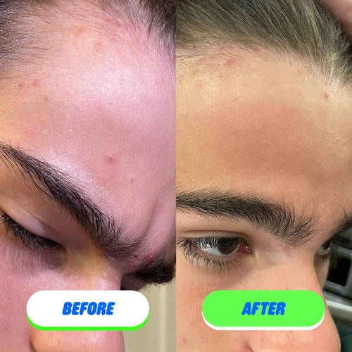 Pipa Skin Saver Hypochlorous Acid Spray for Face & Body 60 ml | Head to Toe Daily First Aid Skin Repair Spray for Sensitive Skin | Helps Reduce Eczema, Irritations, Rashes, Acne, Redness & Breakouts