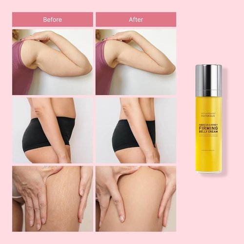 Enaskin Naturals Hibiscus and Honey Firming Cream - Skin Tightening Belly Cream for Loose Skin, Cellulite & Stretch Marks - Anti Aging Body Moisturizer for Stomach, Thighs & Butt - 3.38 Fl Oz