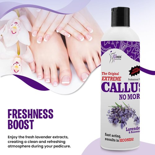 SPA REDI Callus Remover - Professional-Grade Callus Dissolving Treatment - Stop Scraping. Start Dissolving. Chemically Dissolve Toughest Buildup for a Dramatic 'Wow' Transformation 12 Oz