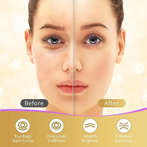 Regine Switzerland Under Eye Patches - 40 Pairs for Dark Circles & Puffy Eyes | 24K Gold & Hyaluronic Acid Treatment