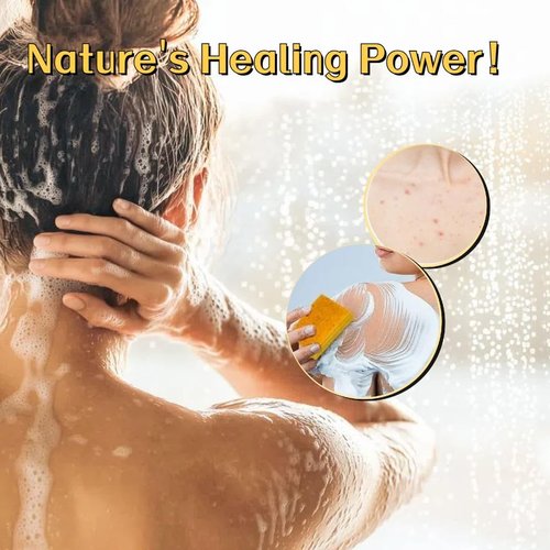 Uselective 3 Pack Lemon & Turmeric Soap Bar for Dark Spots, Powered by Kojic Acid, Vitamin C - Deeply Moisturizing with Amino Acids & Shea Butter - SLS Free for Face/Body