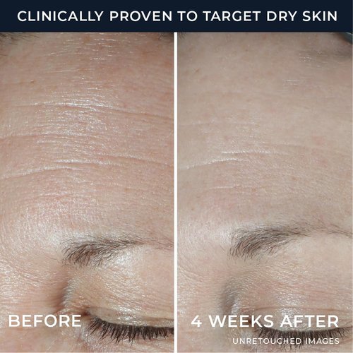RoC Hydration+ Hyaluronic Acid Moisturizer Face Cream Fragrance Free Sensitive Face Moisturizer with Collagen Proteins 1.7 Ounces with Retinol Eye Cream Packette