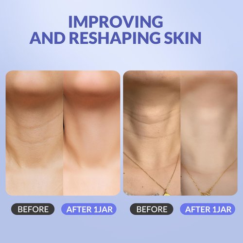 Crogooe Neck Firming Cream - Neck Creams for Tightening and Firming, Tightening and Lifting Wrinkles & Crepey Skin for Neck & Décolleté-1.7 fl.oz