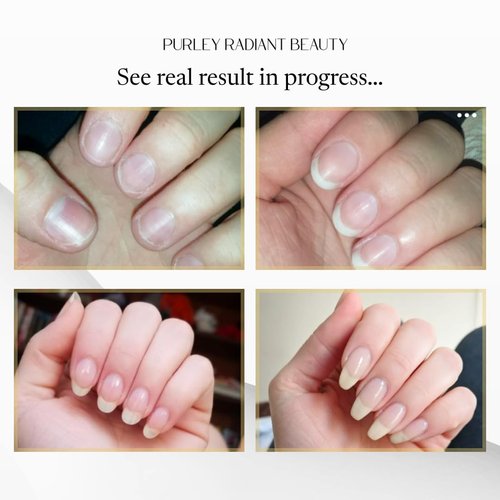 Purely Radiant Beauty Nail Growth Oil – Natural Cuticle Serum for Stronger Nails & Healthy Growth | Jojoba, Castor, Coconut & Argan Oils | Prevents Breakage, Peeling & Brittleness (3ml)