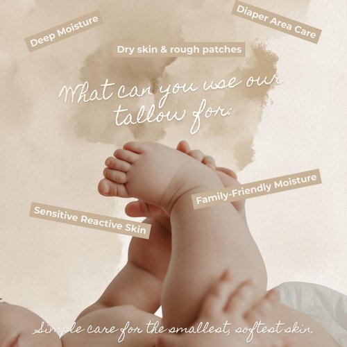 Snuggle Suds Whipped Tallow Balm – 100% Grass Fed Beef Tallow for Baby, Eczema & Sensitive Skin; Double-Infused with Calendula & Chamomile Herbs (Unscented Herb-Infused)