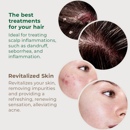 Skiennix Detox Hydrating Gel Hair Mask - Oil Control & Nourishment for Women - Vegan, 7.05oz | Green Clay & Red Seaweed Extracts