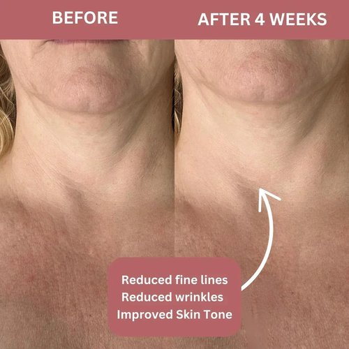 COCOBEAUTY Bio-Collagen Neck Mask - Hydrogel Anti-Aging Neck Patches for Firming & Hydration (4 Pcs)