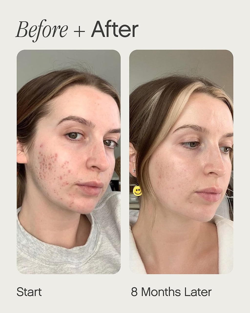 Topicals Faded Brightening Serum - Reduces Discoloration & Blemish Marks | Kojic Acid & Niacinamide | Vegan & Cruelty-Free (0.5 Fl Oz)