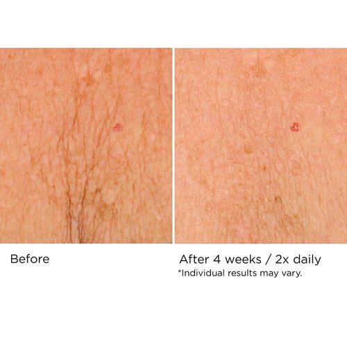 NassifMD Neck & Decollete Firming Complex - Lifting Formula for Youthful Skin