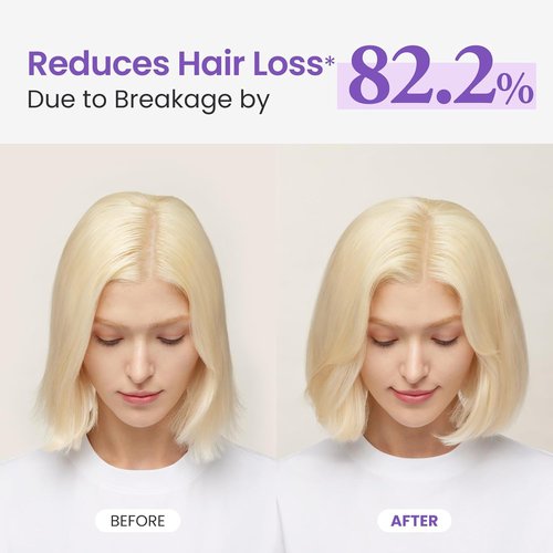 Dr. Groot Rosemary Mint Oil Tonic - Hair Growth Formula with Biotin & Hyaluronic Acid | 3.38 fl oz