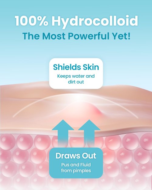 GLAM UP Hydrocolloid Pimple Patches - Invisible, Ultra-Thin Spot Covers for Face & Skin | 36 Count, Vegan-Friendly