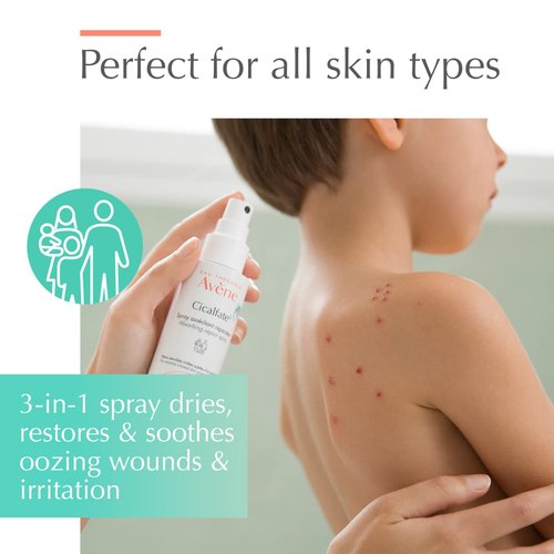 Avène Cicalfate+ Soothing Spray - Restores Irritated Skin & Barrier | Safe for All Ages