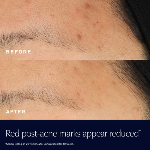 Estée Lauder Advanced Night Repair | 15% Bifidus Ferment Solution to Reduce Redness - 0.68 Fl Oz