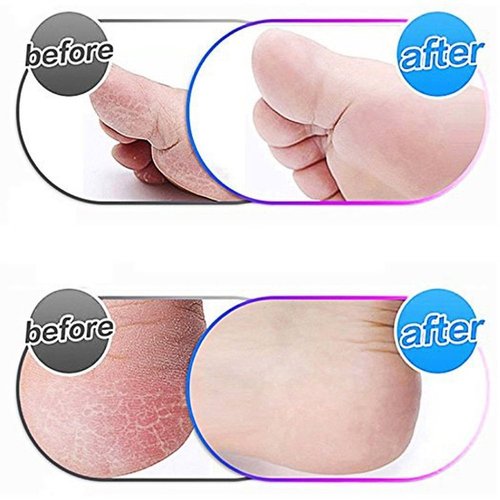 12 Pack Extra Coarse Replacement Roller for Amope Pedi,Replacement Head Refills Compatible with Amope Pedi Refills Electronic Perfect Foot File
