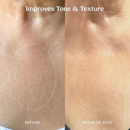Kopari Ultra Restore Firming Body Serum with Dual Peptide Complex, Deeply Hydrates, Improves Skin Tone & Texture, Firms & Enhances Elasticity, 5 oz
