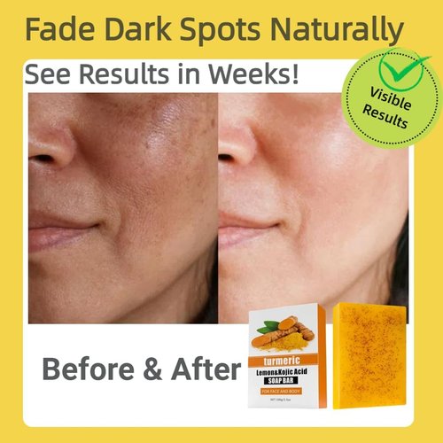 Uselective 3 Pack Lemon & Turmeric Soap Bar for Dark Spots, Powered by Kojic Acid, Vitamin C - Deeply Moisturizing with Amino Acids & Shea Butter - SLS Free for Face/Body