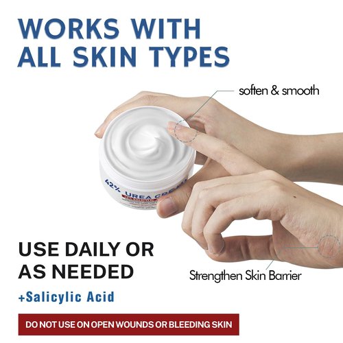 OUKEYA Urea Cream 42% plus Salicylic Acid 2% for Dry Cracked Feet, Heel, Knees, Elbows, Hands – Intensive Moisturizing Cream for Very Rough Skin, 5.29 oz, Pack of 2
