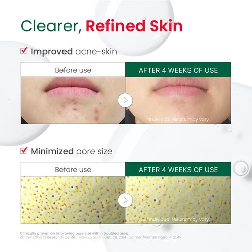 Dr. G R.E.D. Blemish Clear Hyal-Cica Soothing Serum - Korean Skincare - Long-Lasting, Hydrating Serum for All Skin Types - Cools Skin Temperature - Hyaluronic Acid & Centella Asiatica - 1.69 fl oz