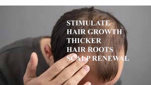 Skiennix DHT Blocker Cream - Promotes Hair Growth & Strength | 4 oz