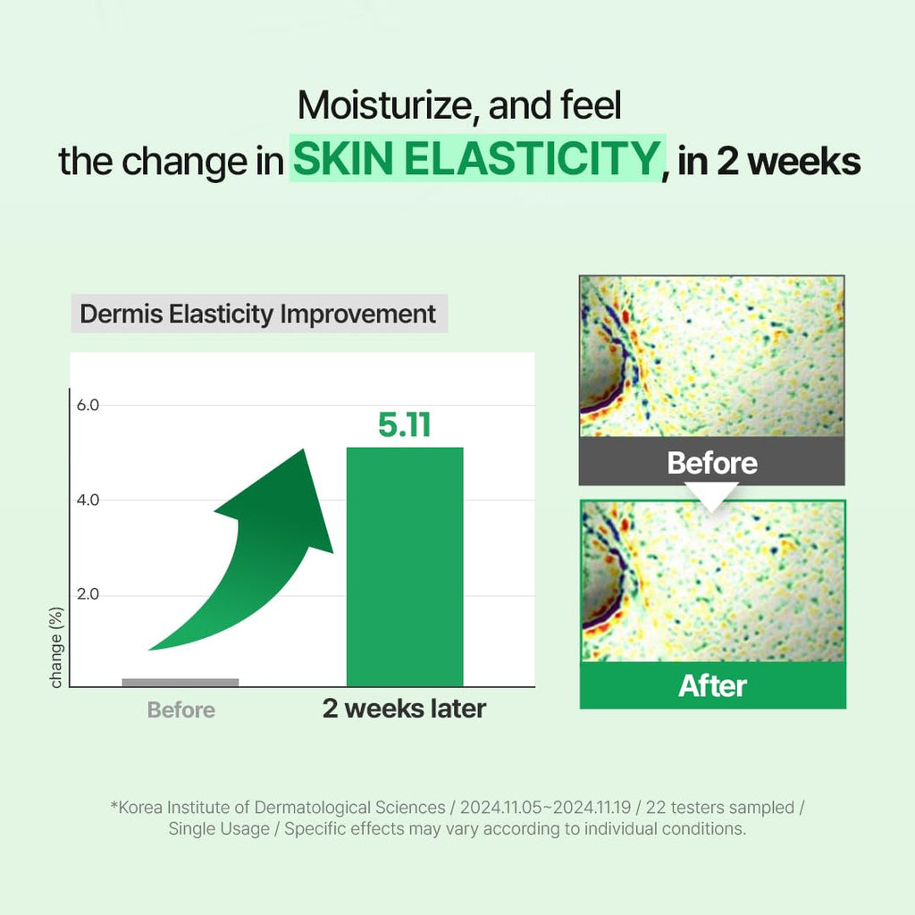 Zipiderm EGF Skin Barrier Intensive Cream – Korean Hydrating Moisturizer for Dry & Sensitive Skin | Ceramides & Panthenol | Lightweight Nourishing Face Cream | 2.70 fl oz
