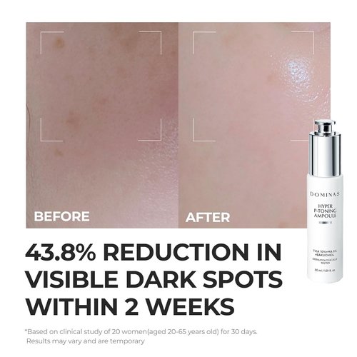 DOMINAS 10% TXA Hyper P-Toning Serum - Brightening & Discoloration Correcting with AHA & Niacinamide | 1.01 fl oz