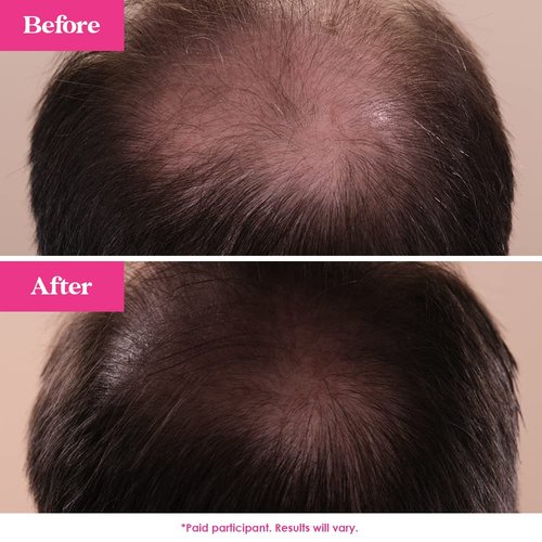 Grande Cosmetics GrandeHAIR Hair Enhancing Serum - Promotes Thickness for Thinning Hair | Safe for Color-Treated Hair