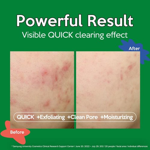 Troubless Clear Toner Pad for Face | Gentle Peeling & Facial Soothing Toner with Tea Tree, 60 Pads (5.57 oz)