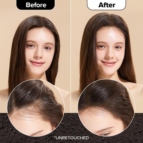 I DEW CARE Biotin Clarifying Dry Shampoo Duo - Strengthening & Volumizing for Brunettes | Travel Size 0.29 Oz * 2